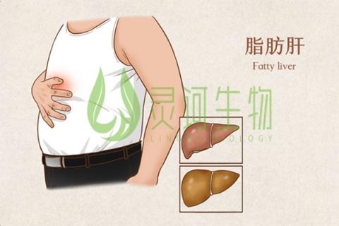 脂肪肝如何消除 脂肪肝患者的注意事项